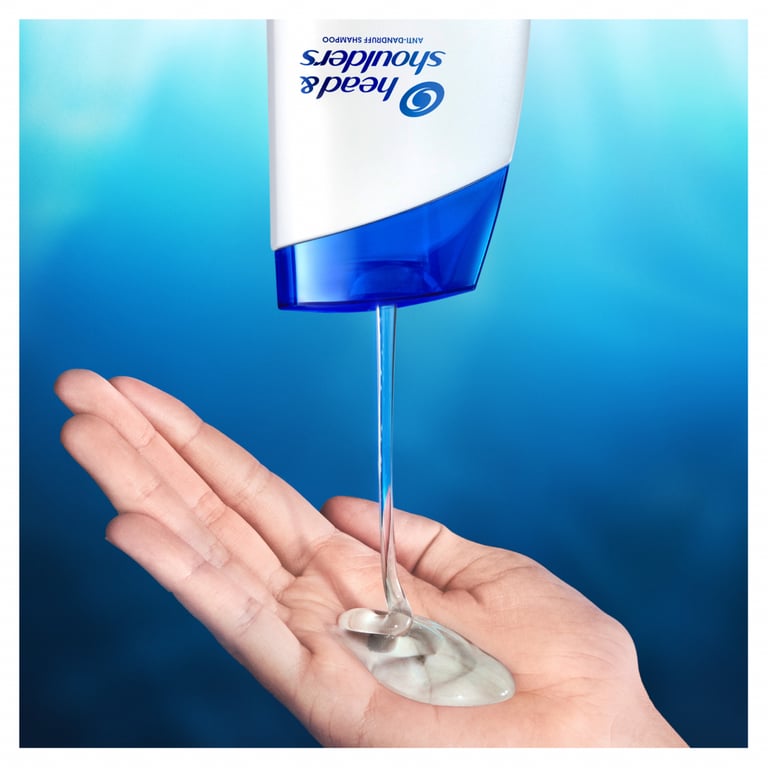 Шампунь Head & Shoulders Глибоке очищення Зняття свербіння 300 мл (8001841996820) - фото 3