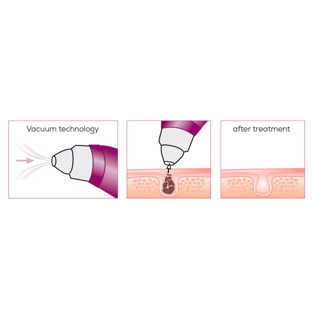 Прилад для чищення шкіри обличчя Beurer FC 41 - фото 7 Прилад для чищення шкіри обличчя Beurer FC 41 - фото 7