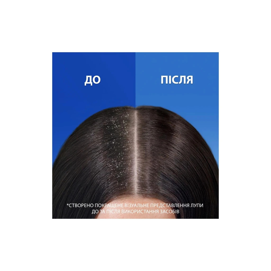 Шампунь Head & Shoulders Men Ultra Проти лупи З ароматом Old Spice 330 мл (8700216305235) - фото 3 Шампунь Head & Shoulders Men Ultra Проти лупи З ароматом Old Spice 330 мл (8700216305235) - фото 3