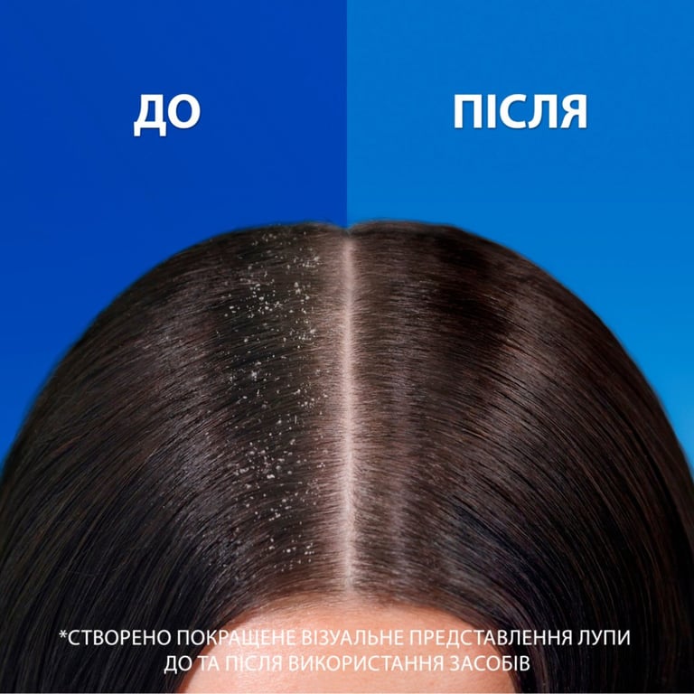 Шампунь Head & Shoulders Pro-Expert 7 Захист від випадіння волосся З кофеїном 250 мл (8700216156936) - фото 6