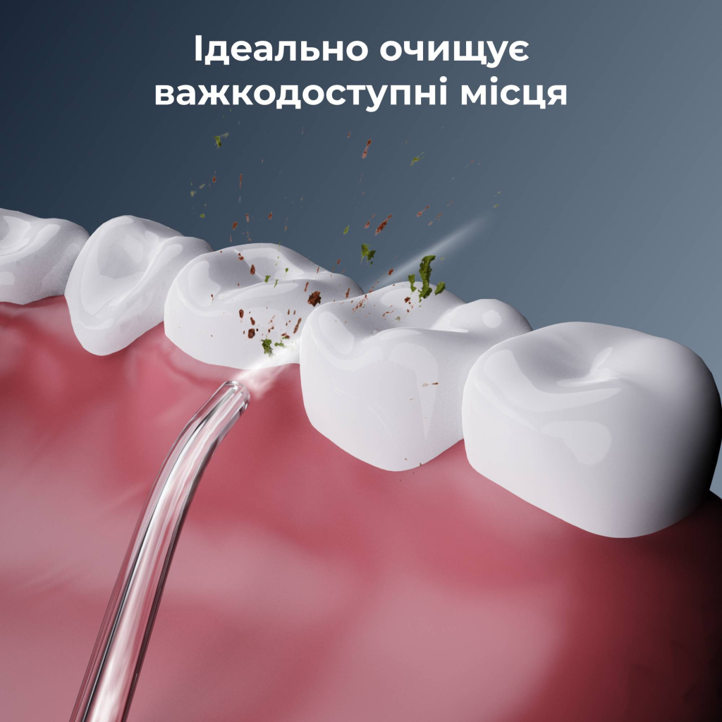 Іригатор AENO DI3 (ADI0003) - фото 2 Іригатор AENO DI3 (ADI0003) - фото 2