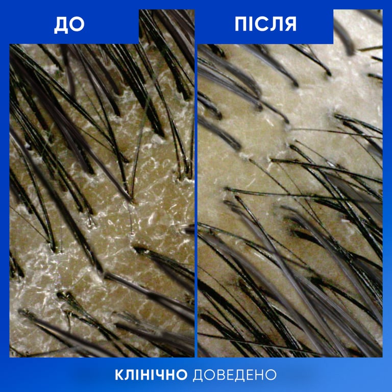 Шампунь Head & Shoulders Clarify & Shine Проти лупи Очищення та блиск 400 мл (8700216658461) - фото 7