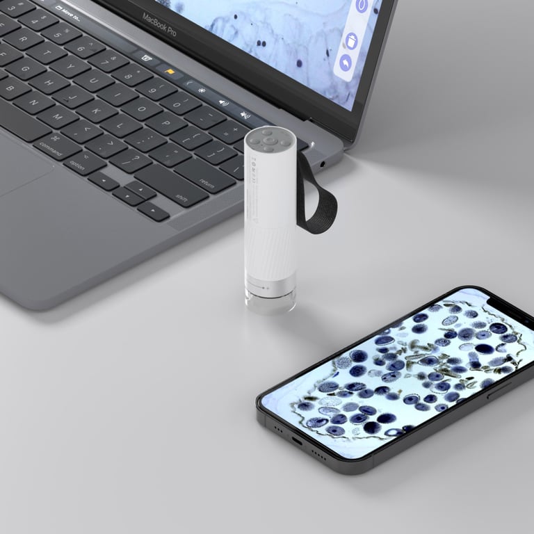 Мікроскоп Xiaomi BeaverLAB DDL-M1 Portable (DDL-M1C) - фото 8