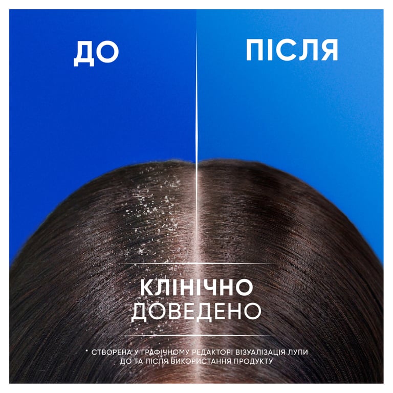 Шампунь Head & Shoulders 2 в 1 Проти лупи Основний догляд 400 мл (8700216304917) - фото 5