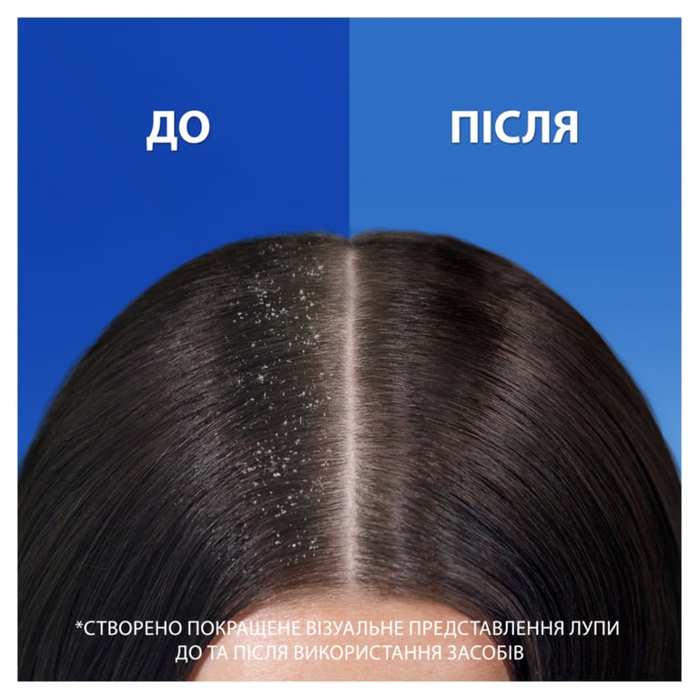 Шампунь Head & Shoulders Проти лупи Проти випадіння волосся 400 мл (8006540833605) - фото 4
